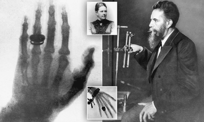 Năm 1895, Wilhelm Röntgen tạo ra bức ảnh X-quang đầu tiên, đánh dấu cột mốc quan trọng trong lĩnh vực công nghệ hình ảnh